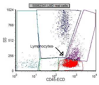 T Cell Large Granular Leukemia LGL Flow Cytometry